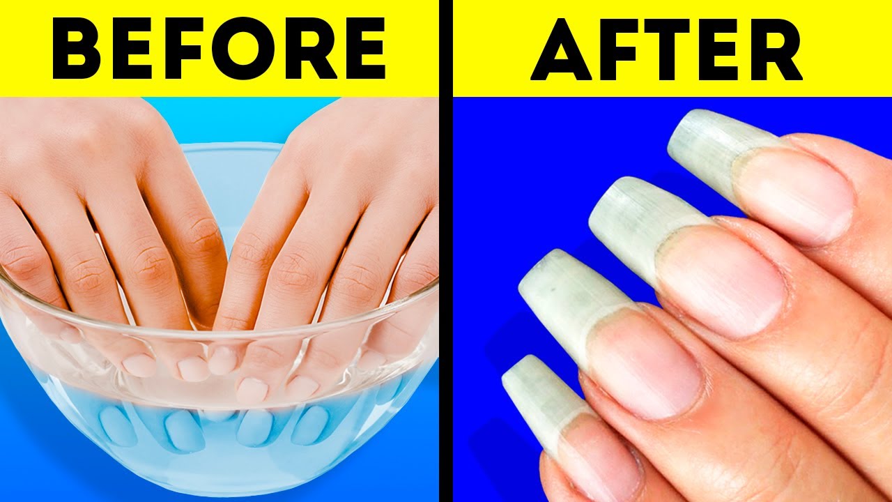You are currently viewing 26 AWESOME NAIL HACKS YOU WILL DEFINITELY LIKE