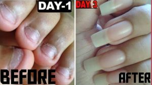 Read more about the article How to Grow Long and Strong Nails in 3 days