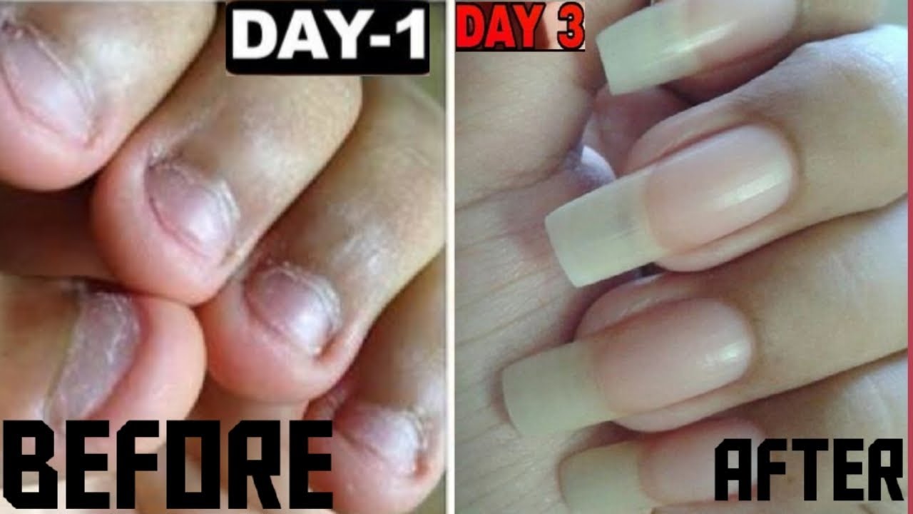 You are currently viewing How to Grow Long and Strong Nails in 3 days