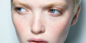 Read more about the article Here’s How To Get Rid of Redness on Your Face,