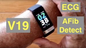 Read more about the article Bakeey V19 Atrial Fibrillation ECG IP68 Waterproof Health Fitness Band: