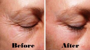 Read more about the article Smooth and Young looking facial skin