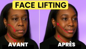 Read more about the article Comment EFFACER LES RIDES en 7 jours