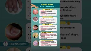 Read more about the article 5 Nail Changes That Signal BIG Health Problems