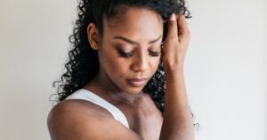 Read more about the article We Asked a Dermatologist to Rate TikTok’s Top Eczema Hacks