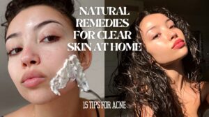 Read more about the article HOW TO MAINTAIN CLEAR SKIN WITHOUT SPENDING MONEY