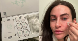 Read more about the article I Tried the TikTok-Viral Microneedling System — and It’s 70%