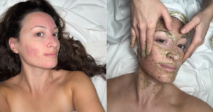 Read more about the article I Tried a “Fiberglass Facial,” and It Made My Skin