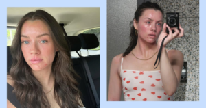 Read more about the article Skinfluencer Madeleine Edwards Doesn’t Let Eczema Flare-Ups Run Her Life