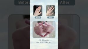 Read more about the article If you want slim fingers, try these finger exercises