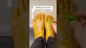 Read more about the article Get Fair Feet Instantly