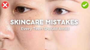 Read more about the article skincare mistakes every teen should avoid (say goodbye to breakouts!)