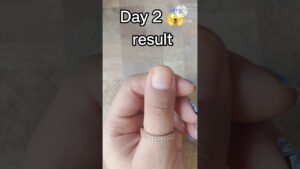 Read more about the article nail growth with in 2 days with Vaseline #nailart #diynails