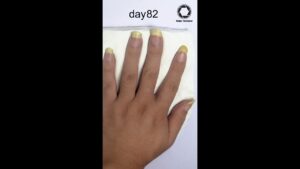 Read more about the article Fingernail Growing Time lapse