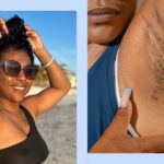 How I Learned to Love My Bumps and Scars From