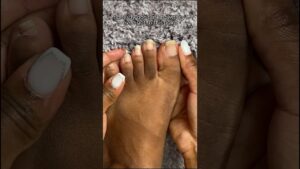 Read more about the article Transform My Toes With Me! #toenails #pedicure #toes #toenailtransformation #gelontoes