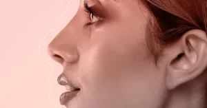 Read more about the article Is Your AI Nose Job Setting You Up For Disappointment?