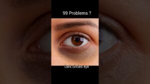 Read more about the article 99Problems for one solutionThe ordinary niacinamideSERUM#skincare#skincaretips#beautytips#selfcare