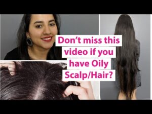 Read more about the article Oily Scalp Home Remedies